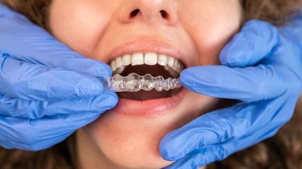 orthodontist Stevenage